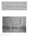 Fig. 07 - Barbed sutures having pledget stoppers and methods therefor