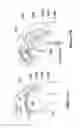 Fig. 17 - IMPLANTABLE PROSTHETIC CORD