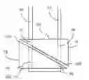 Fig. 01 - Suture anchor and method of use