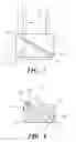 Fig. 04 - Suture anchor and method of use