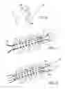 Fig. 05 - Methods and apparatuses for securing suture