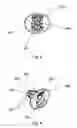 Fig. 04 - Developmental pacifier