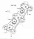 Fig. 50 - Dynamic plate system having moveable segments
