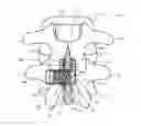 Fig. 01 - Spinous process implants, instruments, and methods