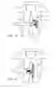 Fig. 14 - Spinous process implants, instruments, and methods