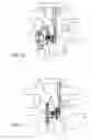 Fig. 19 - Spinous process implants, instruments, and methods