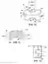 Fig. 05 - SPINOUS FUSION DEVICE