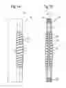 Fig. 08 - Elastic element for the use in a stabilization device for bones and vertebrae and method for the manufacture of such elastic element