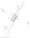 Fig. 07 - Size transition spinal rod