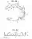 Fig. 04 - Craniotomy closures and plugs