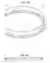 Fig. 08 - Craniotomy closures and plugs