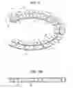 Fig. 11 - Craniotomy closures and plugs