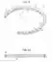 Fig. 12 - Craniotomy closures and plugs