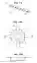 Fig. 20 - Craniotomy closures and plugs
