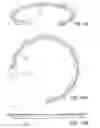 Fig. 26 - Craniotomy closures and plugs