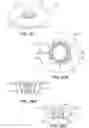Fig. 35 - Craniotomy closures and plugs