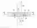 Fig. 01 - Osteosynthesis device with rapid fixing means