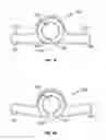 Fig. 09 - System with integral locking mechanism