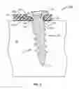 Fig. 02 - LOCKING MECHANISM