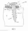 Fig. 03 - LOCKING MECHANISM