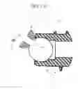 Fig. 11 - Distal interphalangeal fusion device and method of use