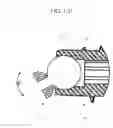 Fig. 12 - Distal interphalangeal fusion device and method of use