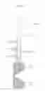 Fig. 43 - Distal interphalangeal fusion device and method of use
