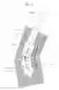 Fig. 47 - Distal interphalangeal fusion device and method of use