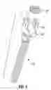 Fig. 05 - Polyaxial Pedicle Screw Assembly