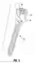 Fig. 06 - Polyaxial Pedicle Screw Assembly