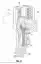 Fig. 09 - Polyaxial Pedicle Screw Assembly