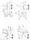 Fig. 14 - Polyaxial Pedicle Screw Assembly