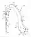 Fig. 01 - Method for implanting a hip fracture nail system