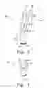 Fig. 04 - Method for implanting a hip fracture nail system