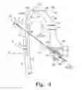 Fig. 07 - Method for implanting a hip fracture nail system