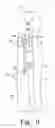 Fig. 10 - Method for implanting a hip fracture nail system
