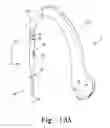 Fig. 14 - Method for implanting a hip fracture nail system