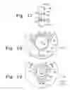 Fig. 17 - Method for implanting a hip fracture nail system
