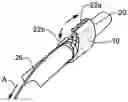 Fig. 01 - Method and apparatus for retaining medical implants within body vessels