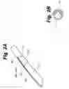 Fig. 03 - Method and apparatus for retaining medical implants within body vessels