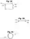Fig. 04 - Method and apparatus for retaining medical implants within body vessels