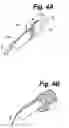 Fig. 05 - Method and apparatus for retaining medical implants within body vessels