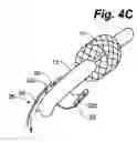 Fig. 06 - Method and apparatus for retaining medical implants within body vessels