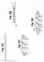 Fig. 10 - Method and apparatus for retaining medical implants within body vessels