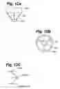 Fig. 18 - Method and apparatus for retaining medical implants within body vessels