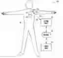 Fig. 01 - Dynamic device therapy control for treating post myocardial infarction patients