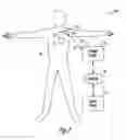 Fig. 03 - Dynamic device therapy control for treating post myocardial infarction patients