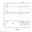 Fig. 15 - Identifying a lead related condition based on detecting noise subsequent to signal delivery