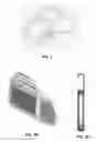 Fig. 03 - Coupling module of a modular implantable medical device
