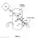 Fig. 12 - Dorsal column stimulation therapy